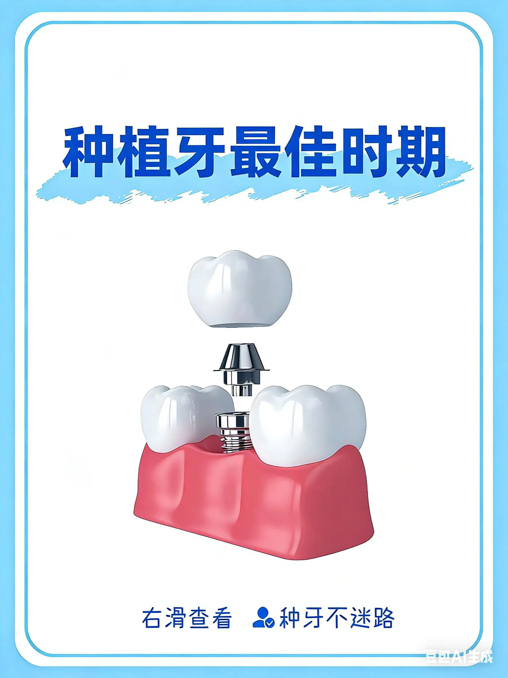 种牙必看！种植牙也有最佳时间。