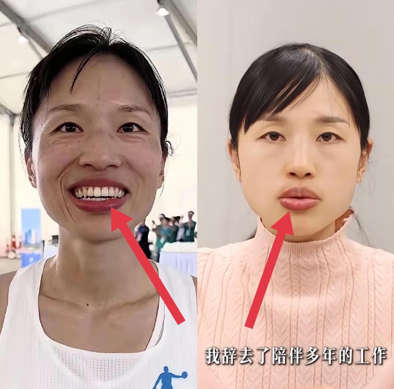 之前刷到她接受采访的时候还意气风发，今天再看差点没认出来。我一开始以为只是美颜