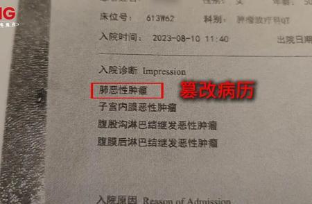 简直离谱！浙江湖州一名五十岁女子查出患上子宫癌，做完手术后医生告知只是一期病情，