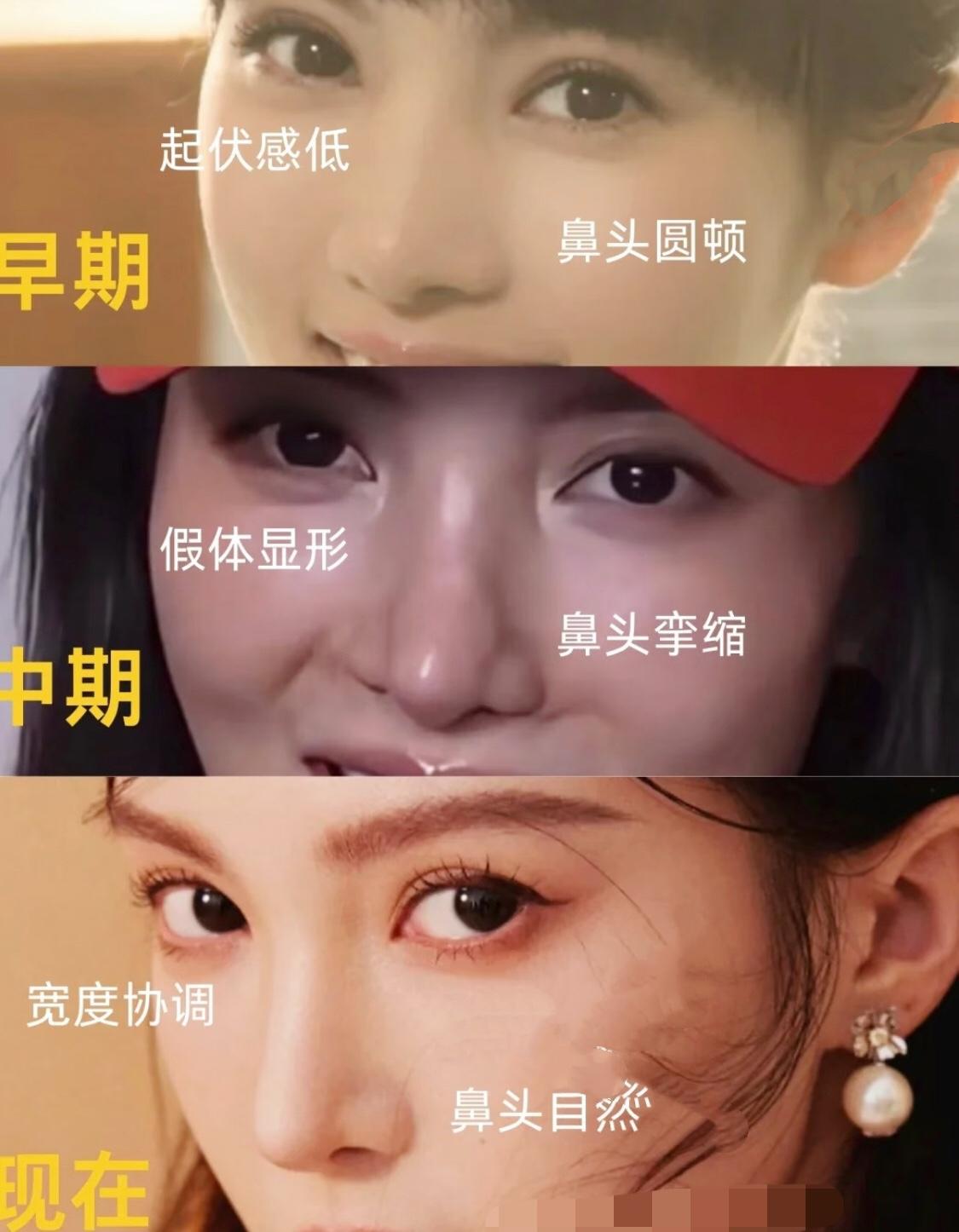金晨又动鼻子了吗金晨身高金晨广告大片金晨明星见面会
