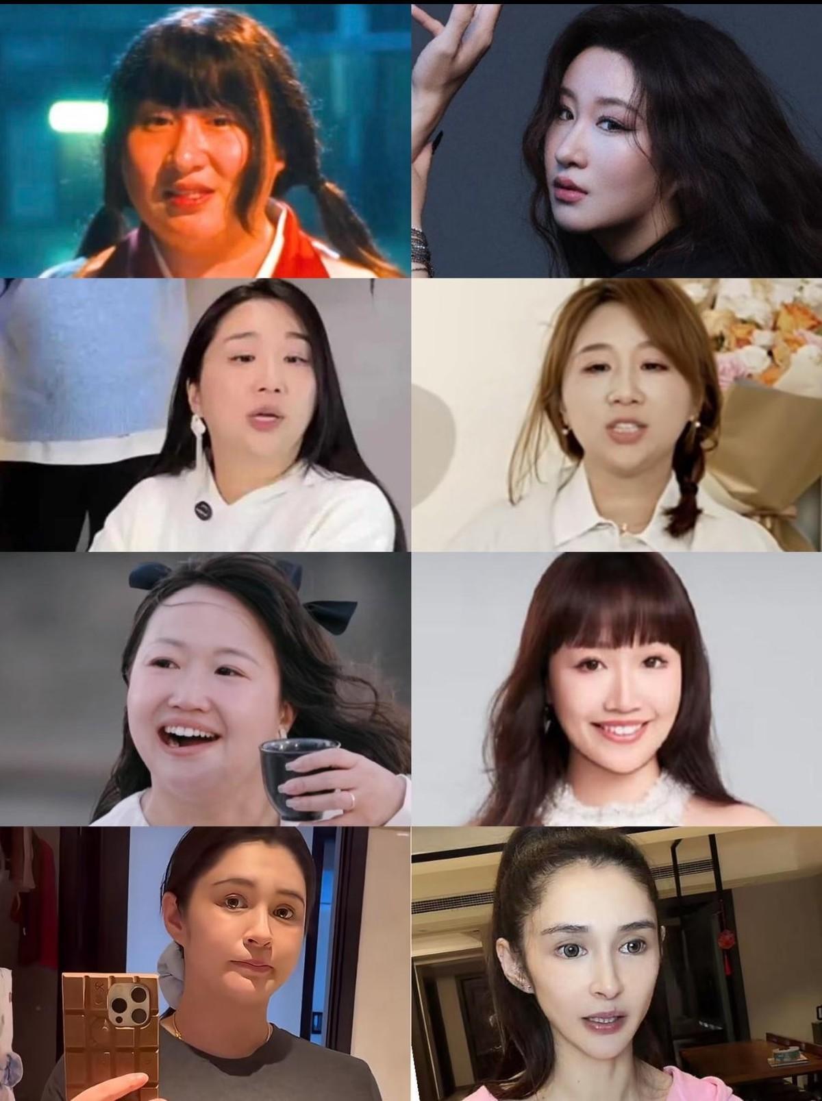 有了减肥针后，明星全都减肥自律起来司美和替尔一出来，能管住嘴了，也能迈开腿了。