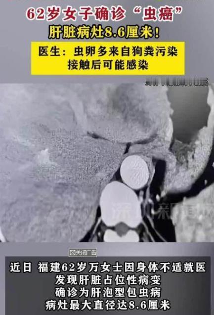 悲剧还是发生了！福建一位62岁大妈，平日里身体硬朗，竟被医生告知，肝脏马上就要被