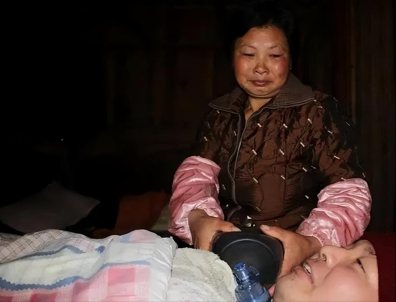 2006年，浙江一小伙意外遭遇车祸，永久丧失自主呼吸功能，父母捏皮球5000万次