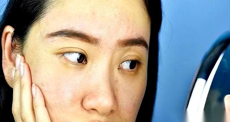 你有没有死死盯过镜子里的自己？别总怪熬夜，血糖高了，脸是第一个“叛变”的。不