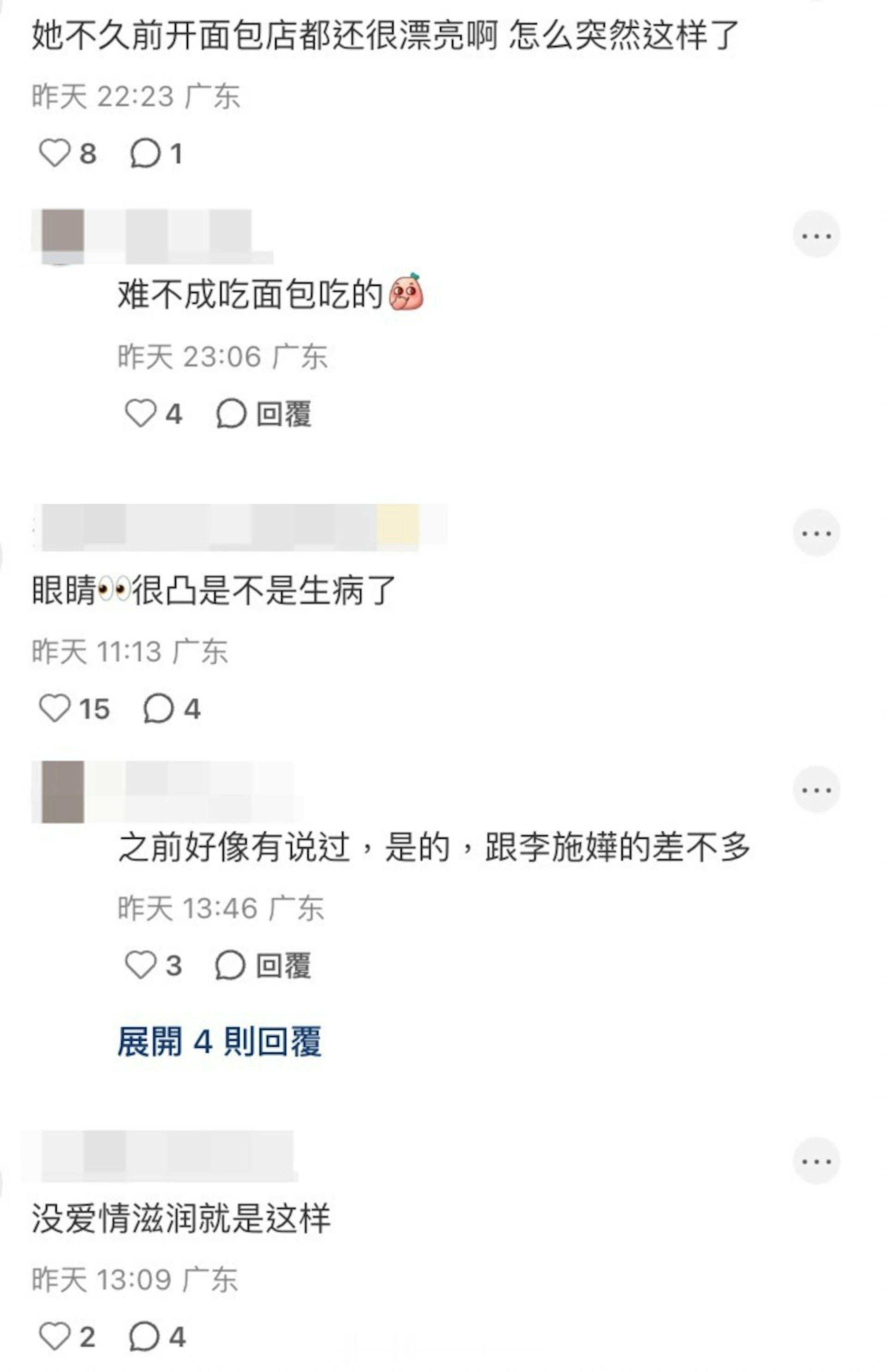 45岁唐诗咏露面状态惹热议面部浮肿松弛现双下巴眼球突出网民忧心健康现年45岁的