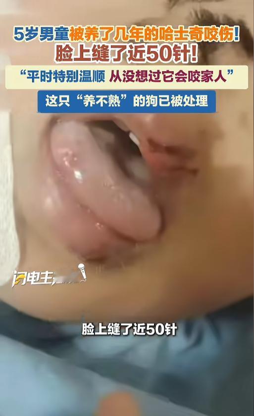 “悲剧还是发生了！”5月1日报道，江苏徐州，一5岁男孩在家中给宠物狗喂零食时，被