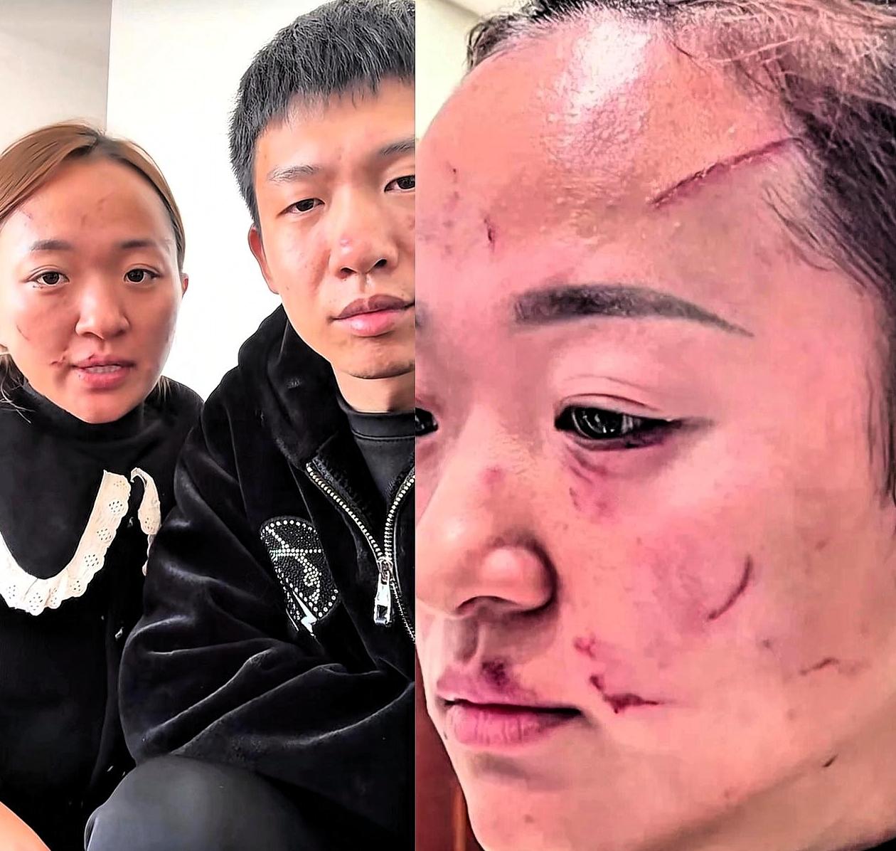 后续来了老妈赔了5万，把儿子一家赶出去了，以后都不来往了。视频里能清楚看