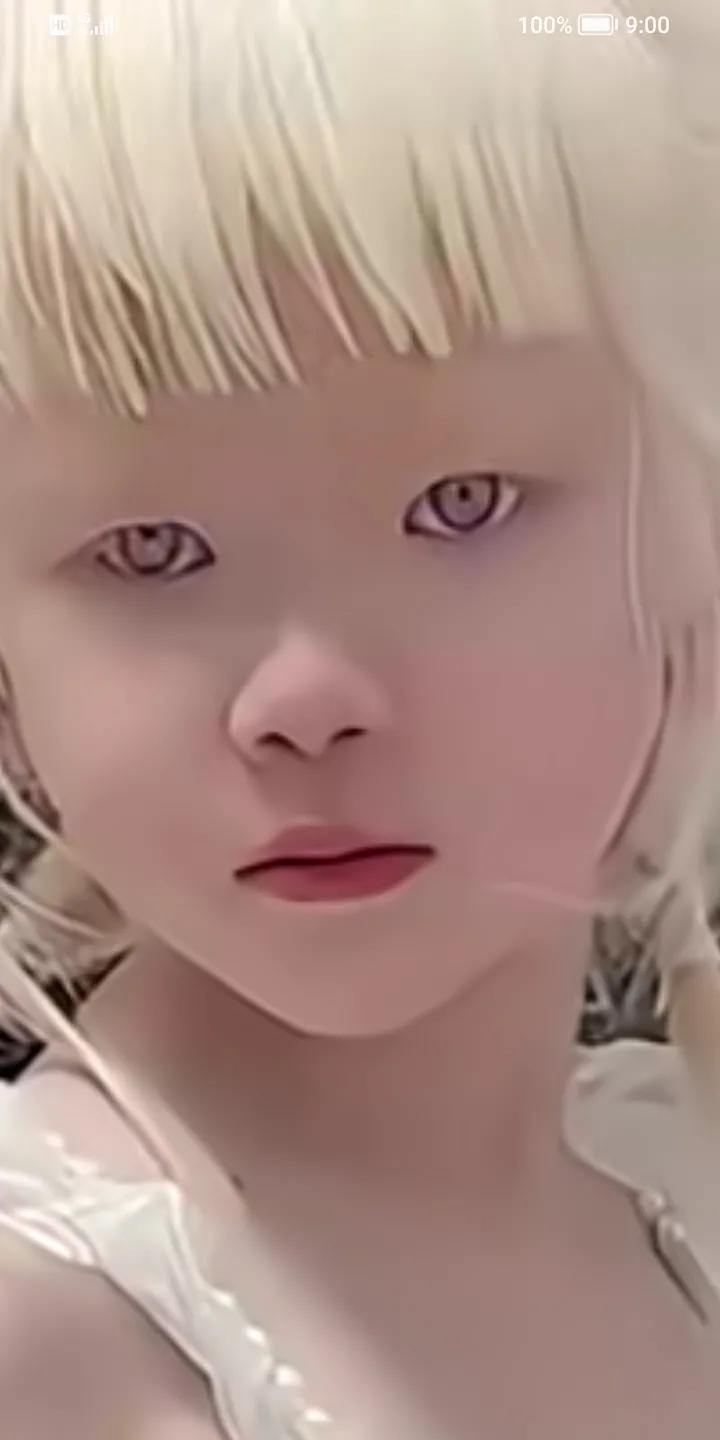恼火，欺负人，白化病女孩在游乐场玩，被两个陌生男孩追着说：好丑，气得女孩直哭，妈