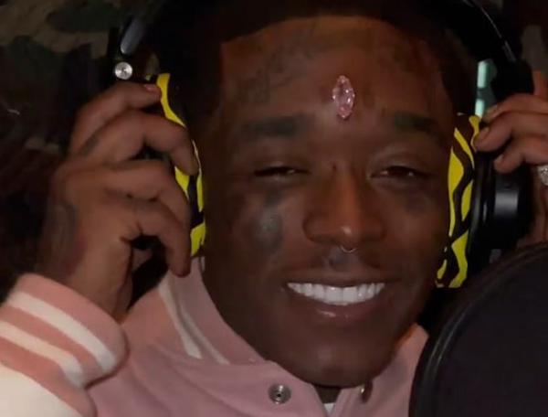 美国说唱歌手LilUziVert，把价值2400万美元的粉钻直接植入额头，这
