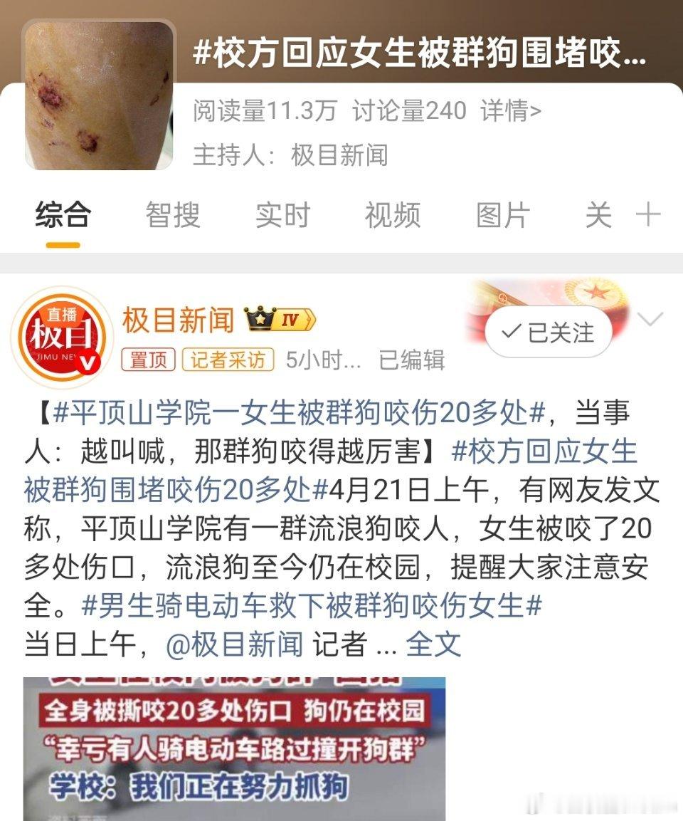 男生骑电动车救下被群狗咬伤女生极目新闻的三个词条，这条是阅读量最少的。