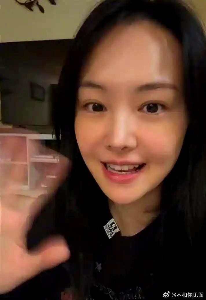 郑爽美国连线粉丝庆生画面曝光，脸部浮肿僵硬难掩激动落泪，发际线上移看着仿佛路人
