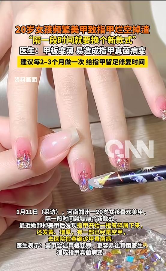 “悲剧还是发生了！”1月11日，河南郑州，一女子特别喜欢做美甲，每隔一段时间都要