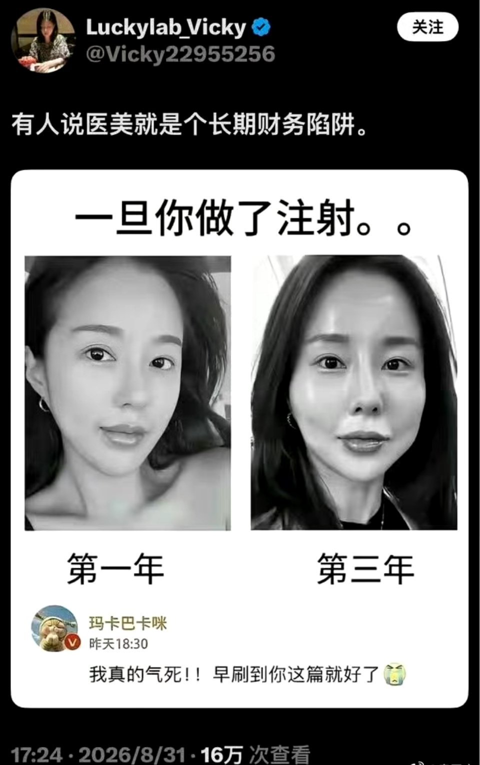 有人说医美就是个长期财务陷阱，比如韩国前第一夫人金建希​​​