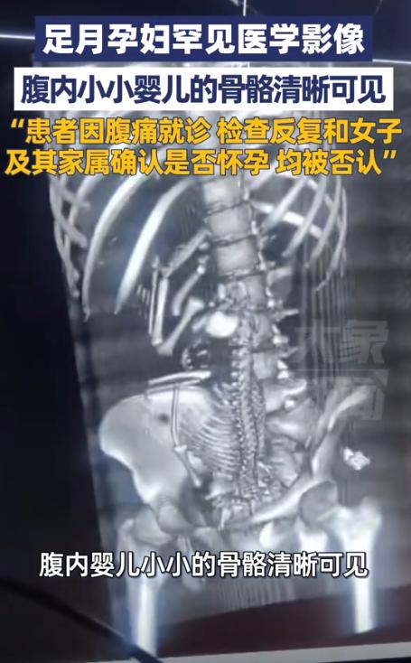 近日，19岁女子腹痛去医院，医生反复跟她和家属确认是否怀孕，都得到否认答复。可影