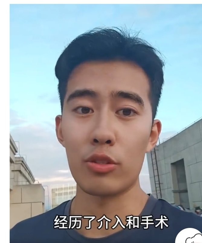 25岁确诊癌症晚期后的忠告他已经抗癌很多年了，怎么突然上热搜了！​​​