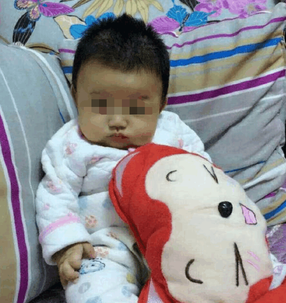几个月的婴儿“患有”皮肤病, 只因家长平时不讲究这个
