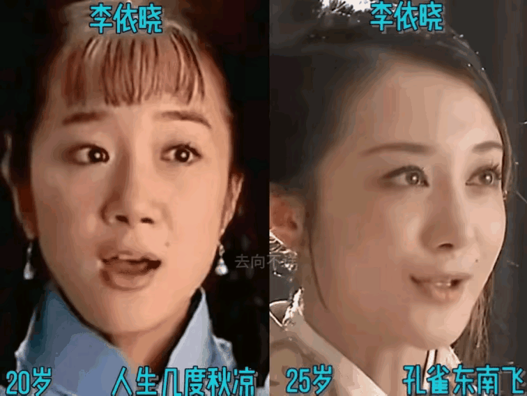 实话实说她整了鼻子然后整张脸变得很高级了不得不说以前她的模样虽然漂亮但是