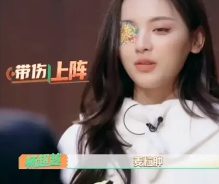 一次节目，杨超越左眼贴着创可贴小心翼翼地走到李成儒等人的面前，英达问道：“你眼睛