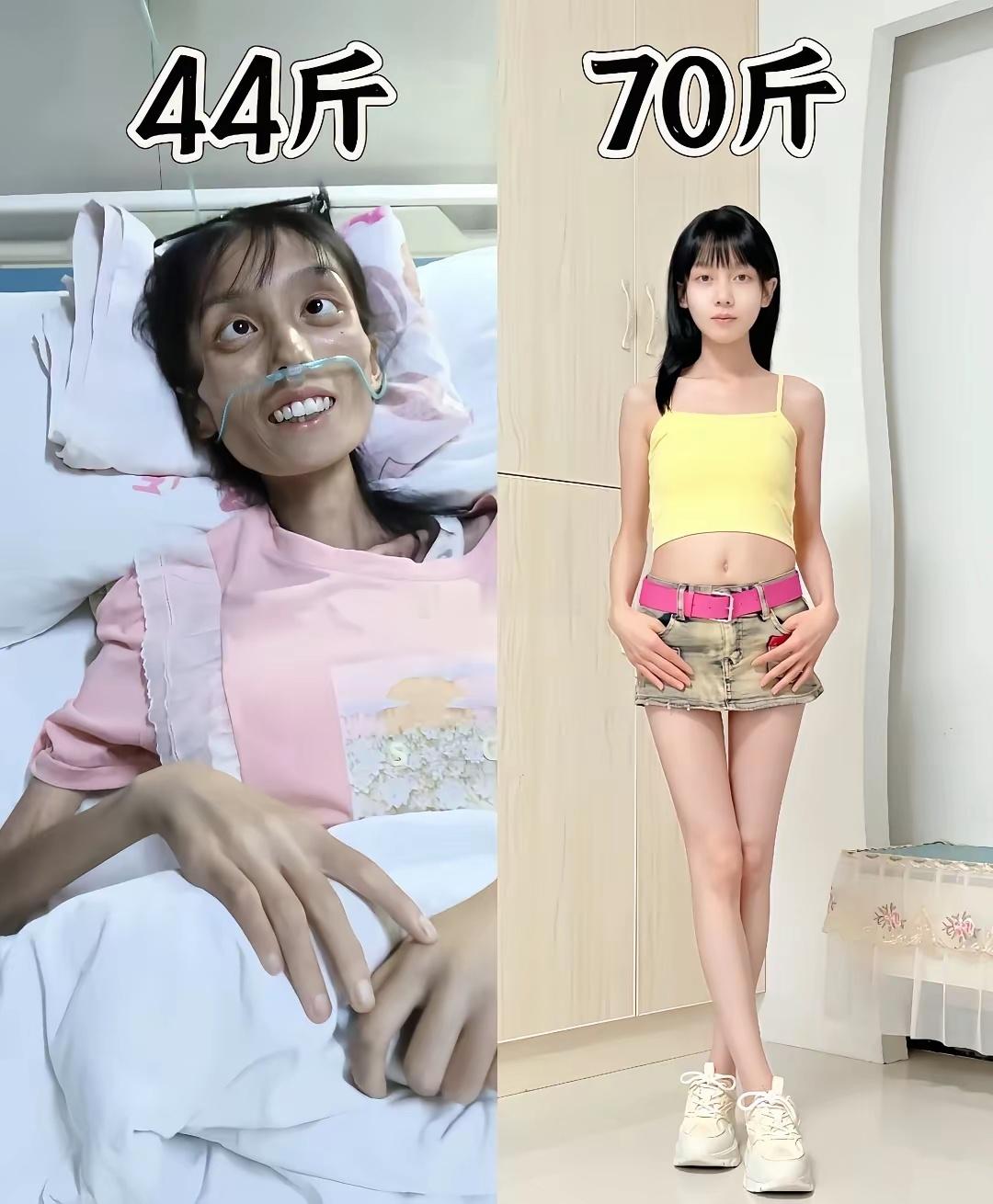 超小基数长胖26斤的变化​​​