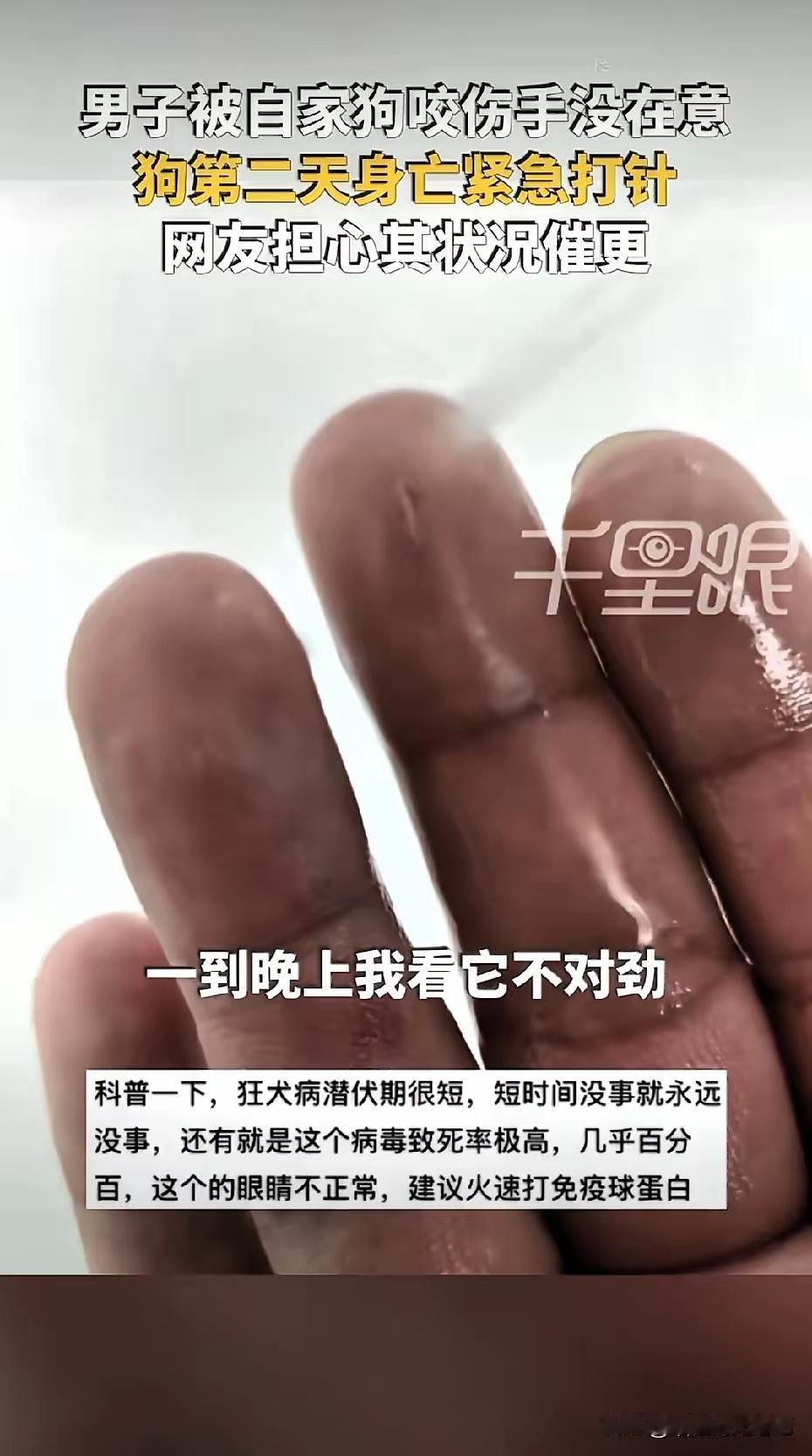 1月5日晚，河南李先生被自家狗咬伤手指未在意，次日下午狗突然死亡，他紧急就医注射