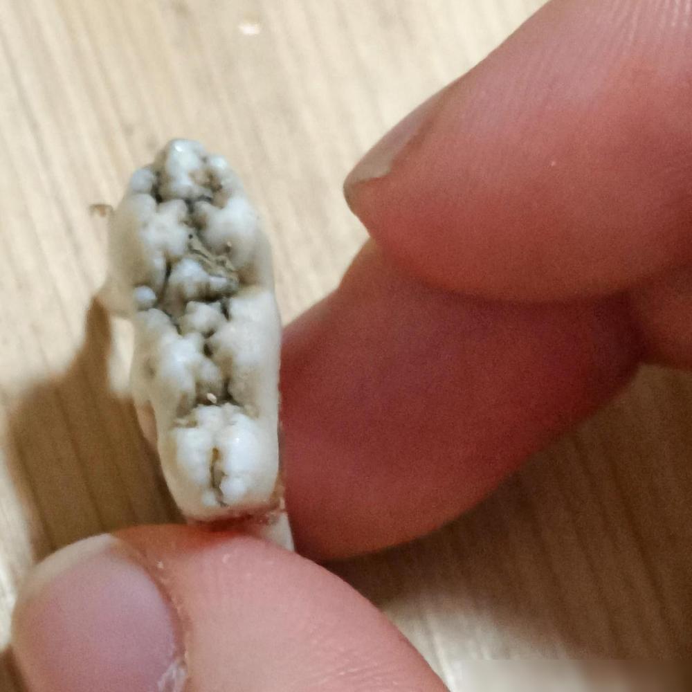 天塌了！哪儿来的牙啊？前几天在家扫地扫出来一颗牙，长的跟智齿一样，结果今天又扫出