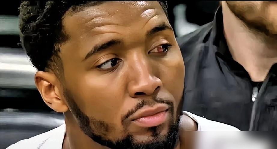 别光看米切尔眼角流血，更衣室里早就在流血了。哈登放弃230万，不是来辅佐，是来夺