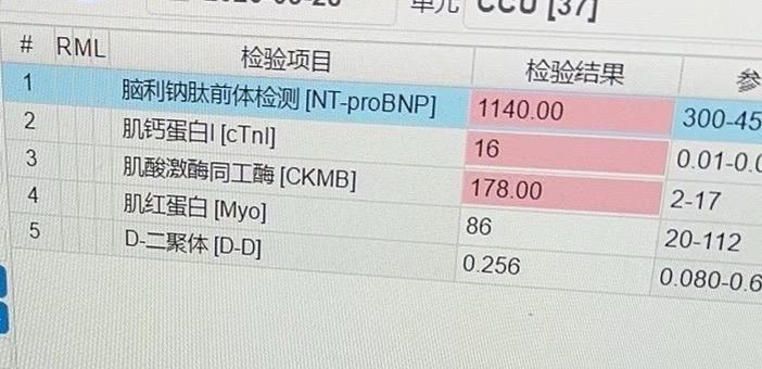 一个夜班收了五个急性心肌梗死的年轻男人最近30几岁40几岁的心梗胸痛病人