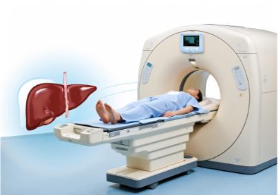 这两种CT检查不能随便做，别等吃了亏才后悔！很多人看病时分不清普通CT、增强