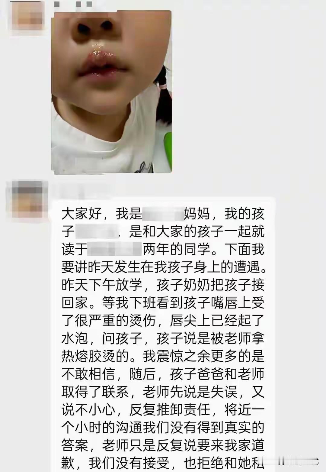 丧心病狂！幼儿园孩子排队等老师举起那把滚烫热熔胶棒按自己嘴上？有的被狠狠烫二次，