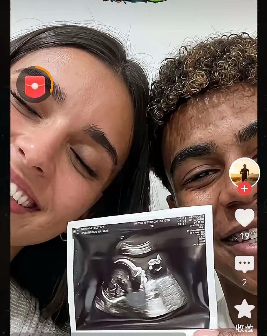 西班牙球星亚马尔快要当爸爸了，亚马尔这是继承了他爸爸的光荣传统，他爸爸也是这个年
