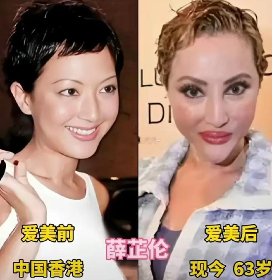 本来个个都是纯天然的绝世颜值，可过度执着医美之后，颜值直接大跌，哪一位最让你惋惜