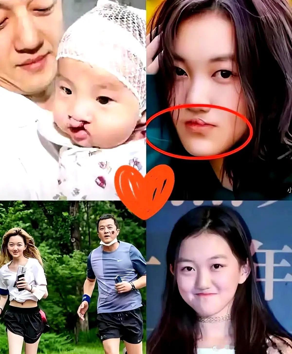 刚看到李嫣18岁登台主持的照片，气场全开。谁能想到，当年医生可是暗示过李亚鹏“这