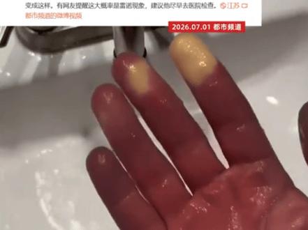 🐰看着就吓人！7月1日报道，江苏一名男子在23度的空调房里睡午觉