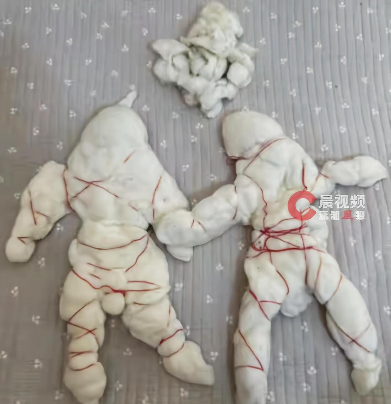河南焦作，一名女子结婚九年，一直使用婆婆亲手缝制的新婚喜褥，从未拆开检查。今年生
