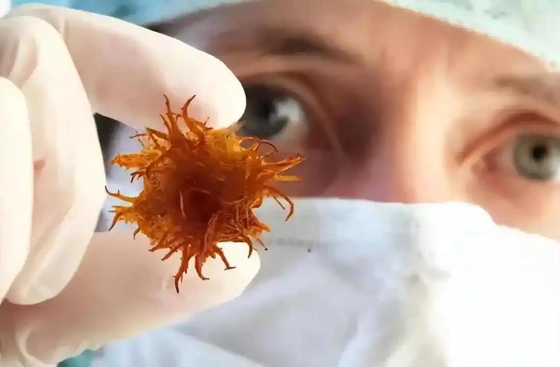 癌细胞最怕的这四种食物，建议每天换着吃！说到癌症，很多人第一反应是“谈癌色变”