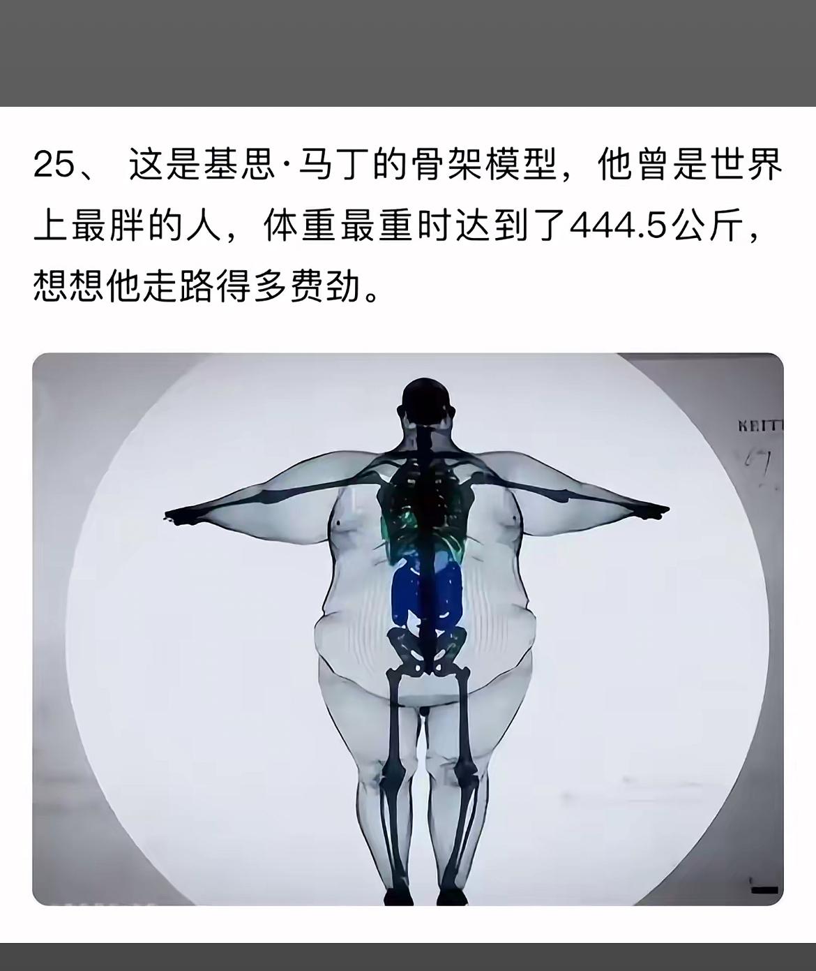 基思·马丁的骨架模型：世界上最胖的人，体重最重时达到444.5公斤！