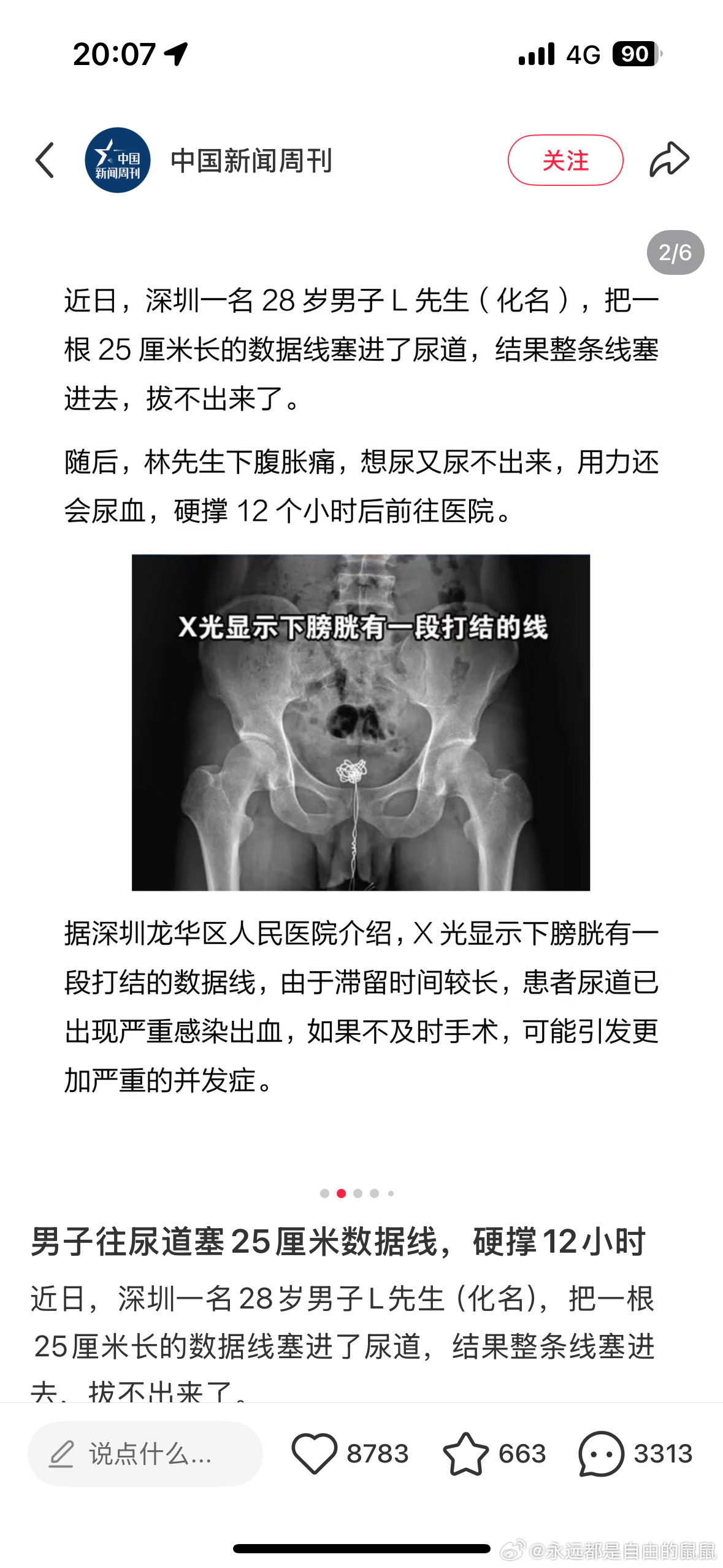 卧槽牛逼