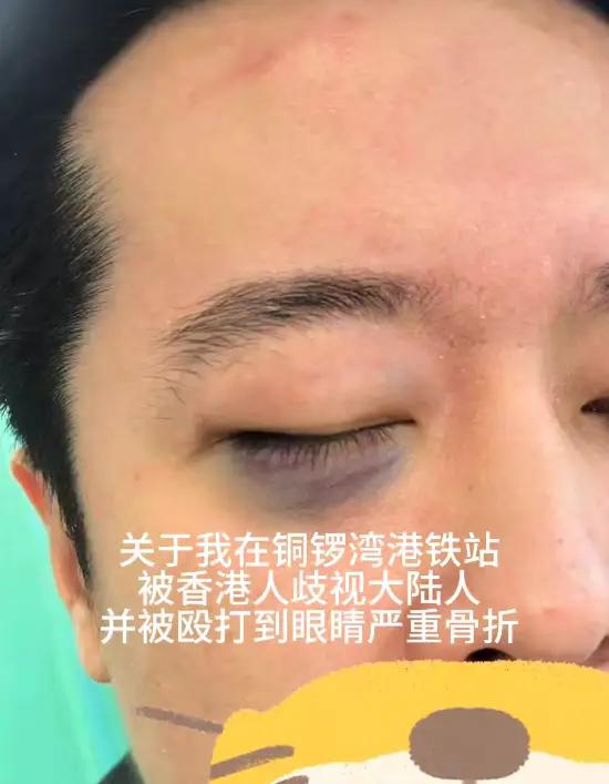 博主在香港铜锣湾地铁站因为朋友的伞可能碰到了一对青年直接遭对方辱骂“大陆人滚