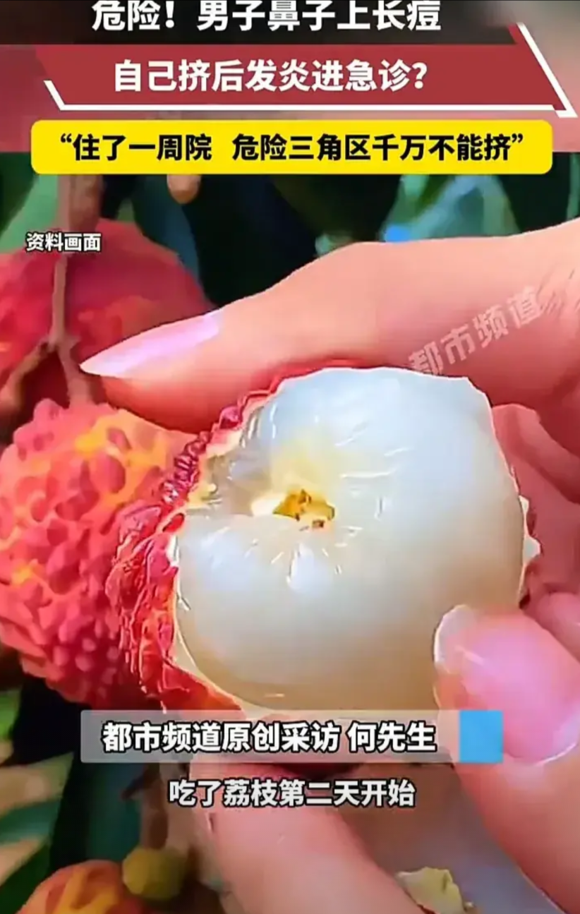 太悲催了！7月11日，广东一名男子吃完荔枝后第二天，鼻子开始长痘变得红肿，于是自