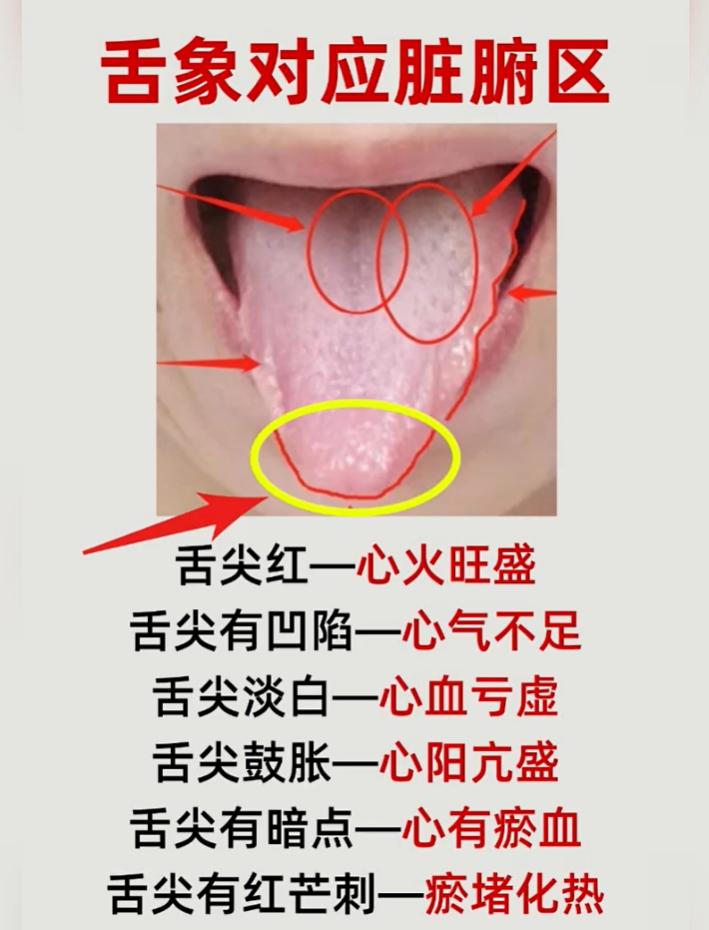 舌象脏腑分区科普：舌尖、舌边、舌中、舌根分别对应哪里