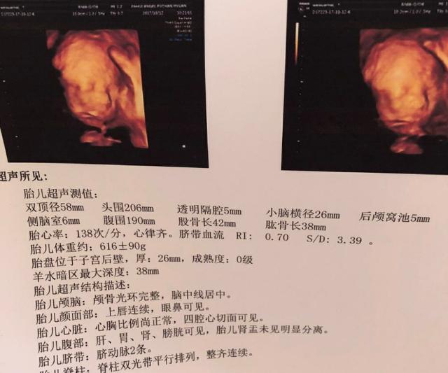 39+2, 顺产8.8斤大胖小子, 来还愿, 感谢姐妹们的好孕, 接好孕啦