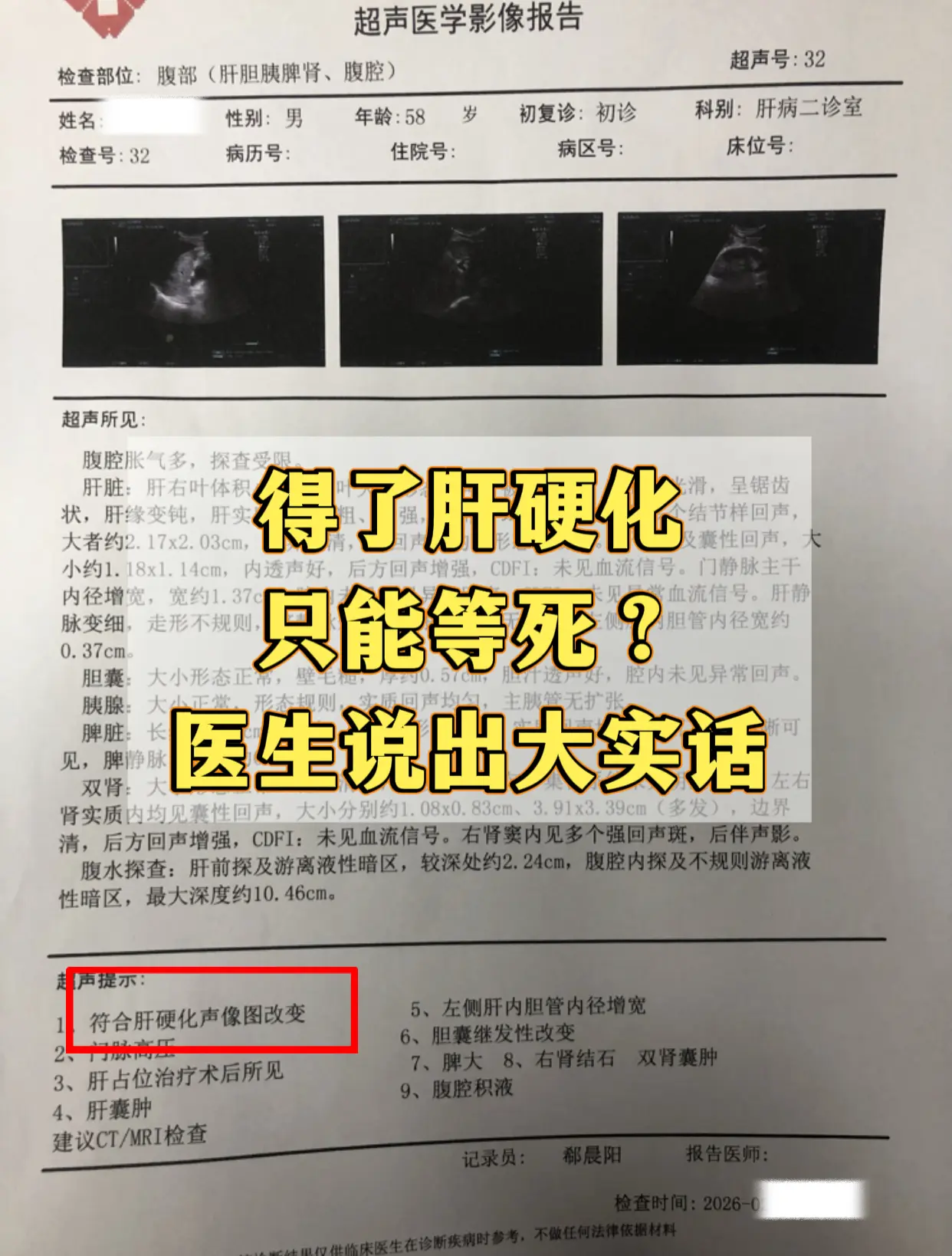 上周接诊一位五十多岁患者，查出肝硬化后觉得自己没救了，干脆放弃治疗不想...