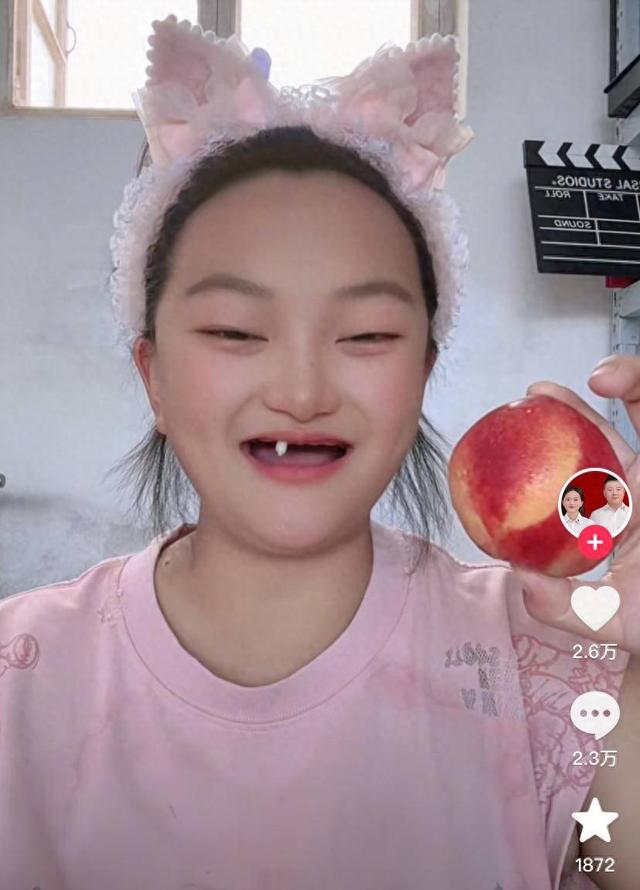 女子用一颗牙啃水果引热议 医生提醒: 这种牙齿缺失遗传是主因