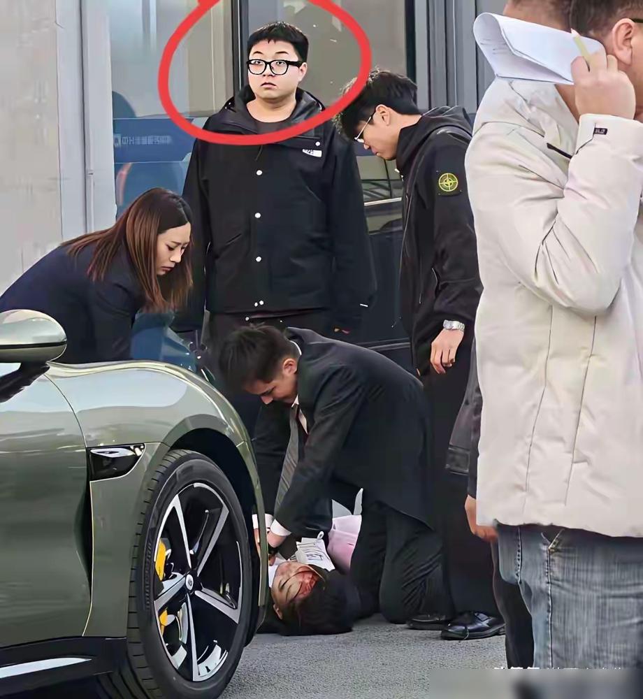 杭州小米汽车事故的车主为啥这种表情？这是吓住了还是觉得不可思议，一脸懵逼？​