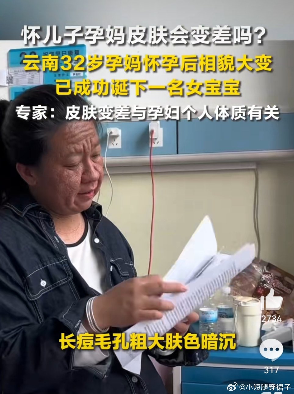 32岁孕妈怀孕后容貌变化明显我的妈呀，这谁还敢生孩子，这直接是换头吧