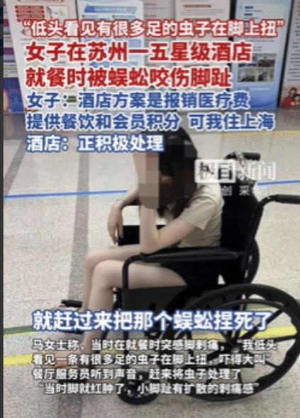 够吓人的！江苏苏州，一女子在5星级酒店吃饭时，脚趾突然传来一阵刺痛，低头看去，竟