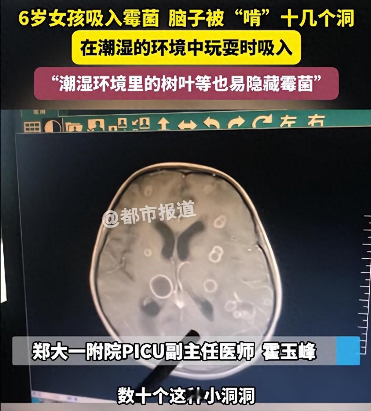 家里出现了这种东西一定要赶紧处理掉，平时还要勤开窗通风。6岁的小女孩发烧17天