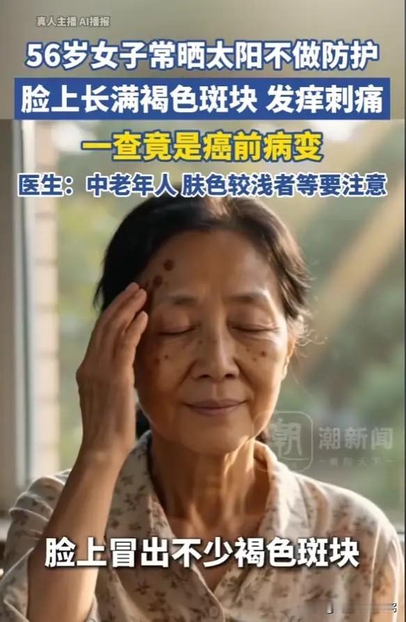 浙江，一女子经常晒太阳，却不做防护，她脸上长出不少褐色斑块，她刚开始还以为是老年