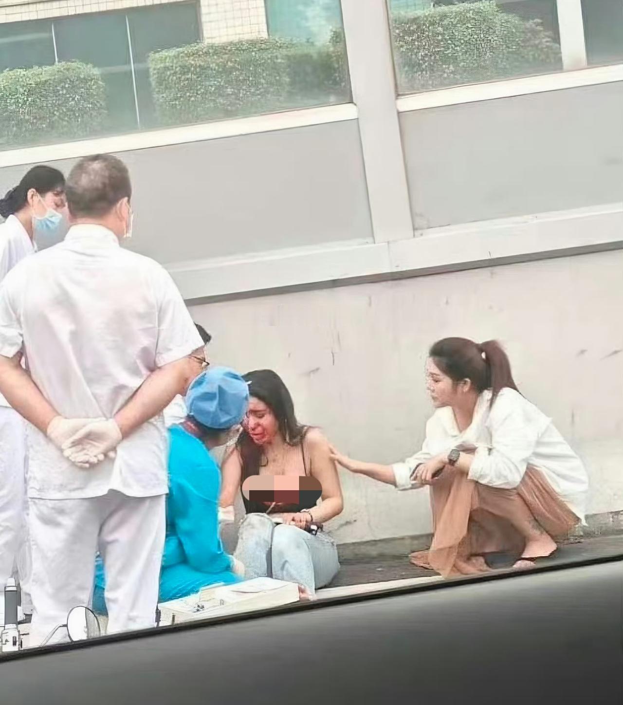 广州这个靓女骑小电驴上高架，出了单边的交通事故，摔得口鼻流血，看起来就让人心疼。