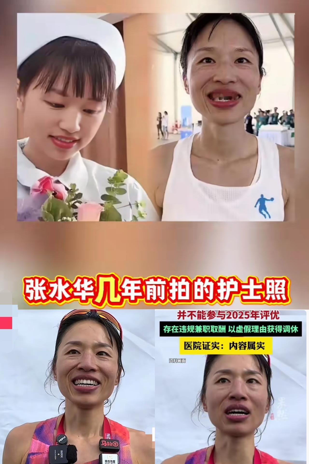 仔细看张水华这张照片，大家发现一个细节没有，不是她的嘴巴大，而是她很明显